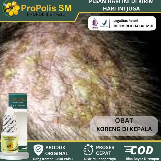 Salep Oles Koreng Herbal, Koreng di kepala, Luka Koreng di Kulit Kepala, Oles Koreng di Kepala, Sale