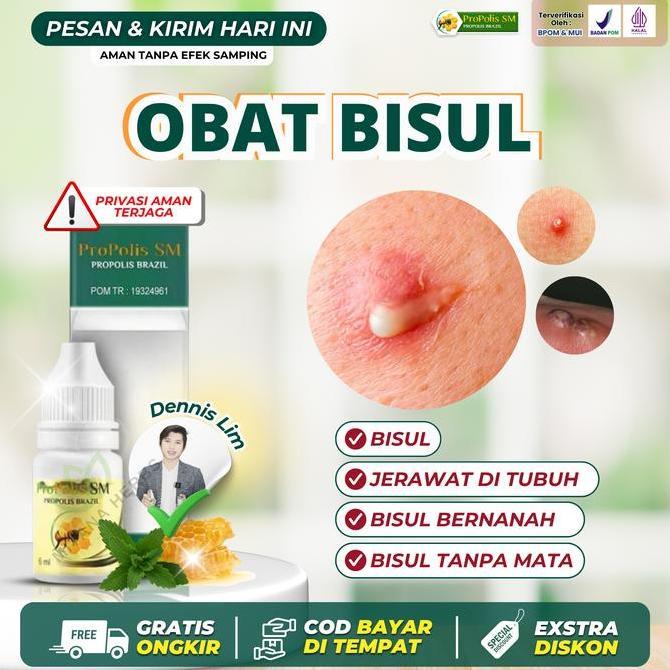 Promo Propolis Sm Obat Bisul Jerawat Di Kulit Bisul Bernanah Di Seluruh Tubuh Benjolan Bisul Tanpa M