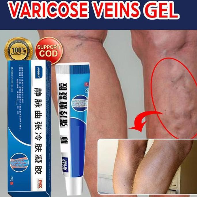 Bodies- Varicose Veins Cream Pembesar Veins Ampuh Obat Varises Di Kaki Dan Betis Paling Ampuh Obat V