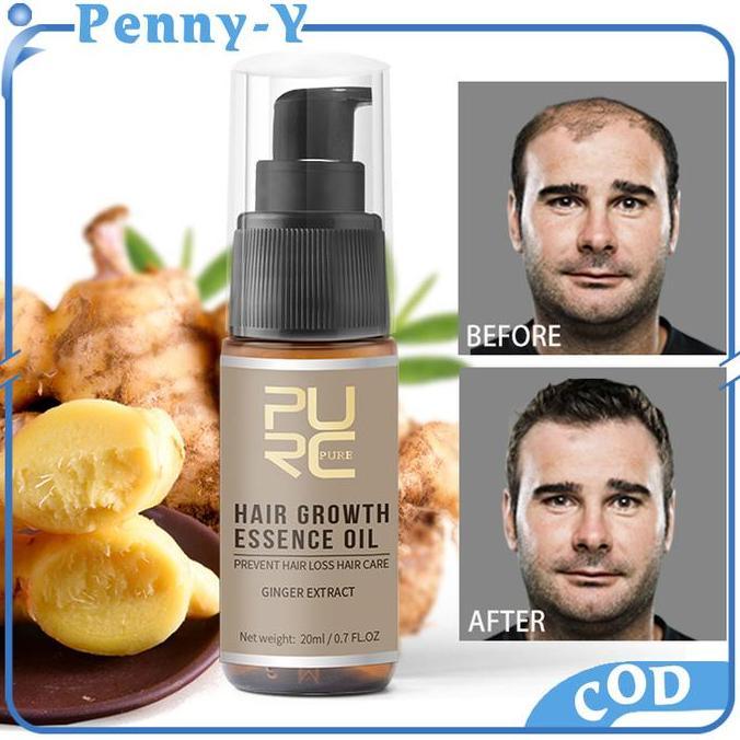 LOLY PURC Serum Penumbuh Rambut 20ml Penumbuh Rambut Pria Wanita Minyak Penumbuh Rambut