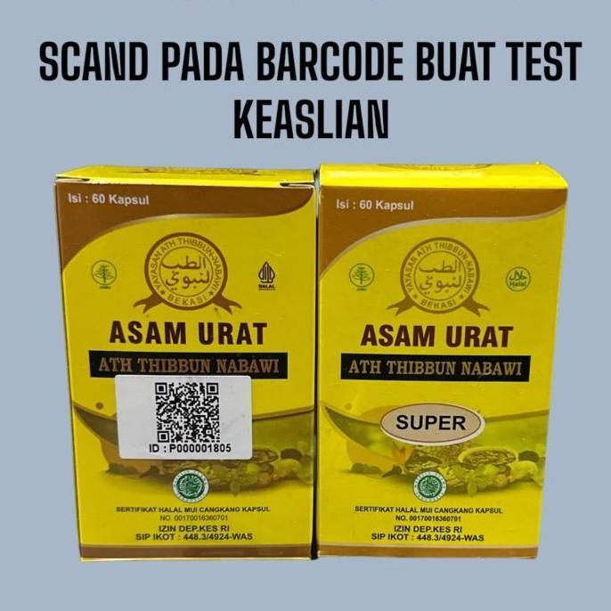 Medisxo- Ciri Ciri Asam Urat Super Asli