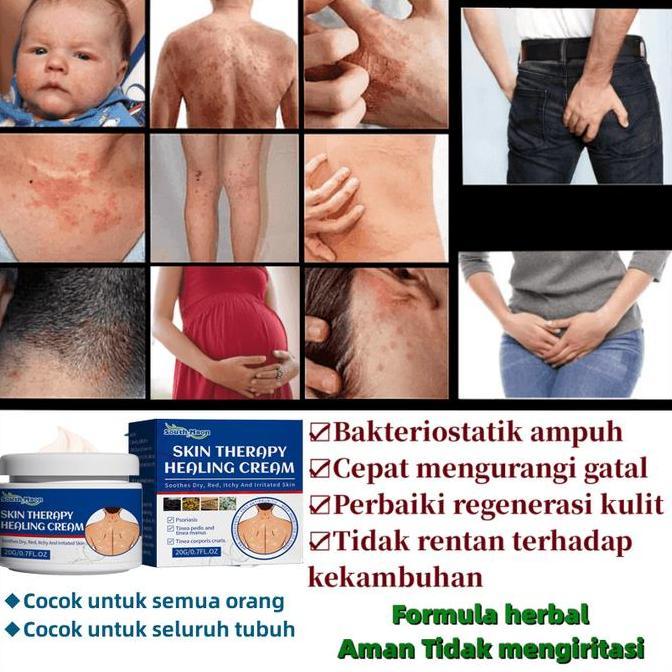 Uvanimal - Salep Gatal Eksim Kulit Krim Psoriasis Paling Ampuh Salep Gatal Selangkangan Gatal Dan Hi