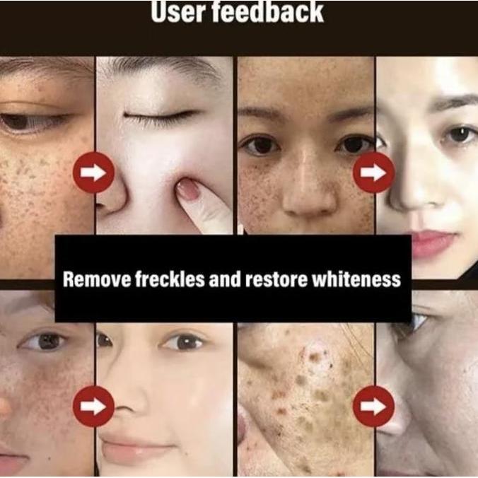 Utsukushi- Meetface Masker Wajah Menghilangkan Bintik-Bintik Topeng Koyak Anti Penuaan & Kedut Kolag
