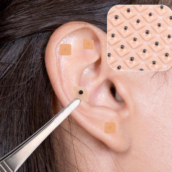 COKRODJOYO 60Pcs Koyo Pijat Telinga Biji Terapi Telinga Plester Akupuntur Moksibusi Biji Akupunktur 
