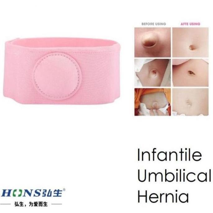 ZHOUCOZI Sabuk Hernia Bayi / Sabuk Pusar Bodong terapi anti udel bodong anak ba