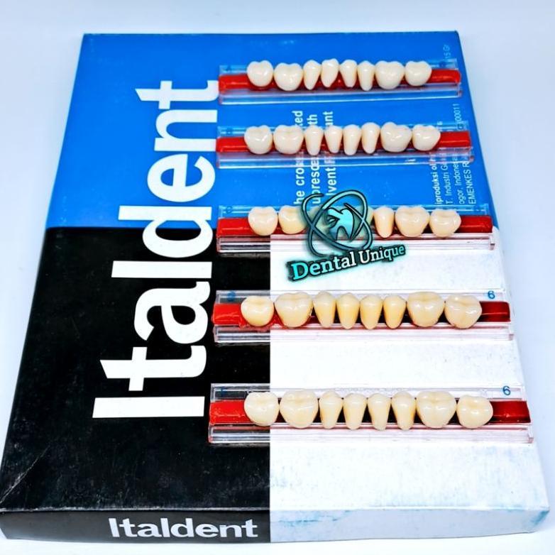 Gigi Palsu Italden Geraham Bawah