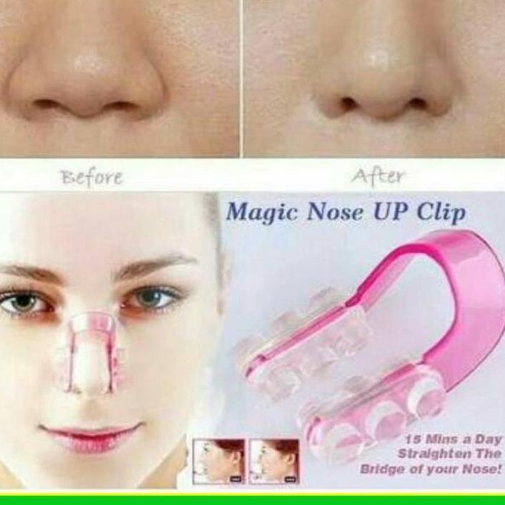 NEW PEMANCUNG HIDUNG - NOSE UP - ALAT TERAPI MEMANCUNGKAN HIDUNG PEMANCUNG HIDUNG - NOSE UP - ALAT T