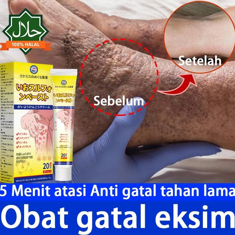 Terlaris Salep Eksim Salep gatal Salep psoriasis Saleb gatal paling ampuh Digunakan untuk meredakan 