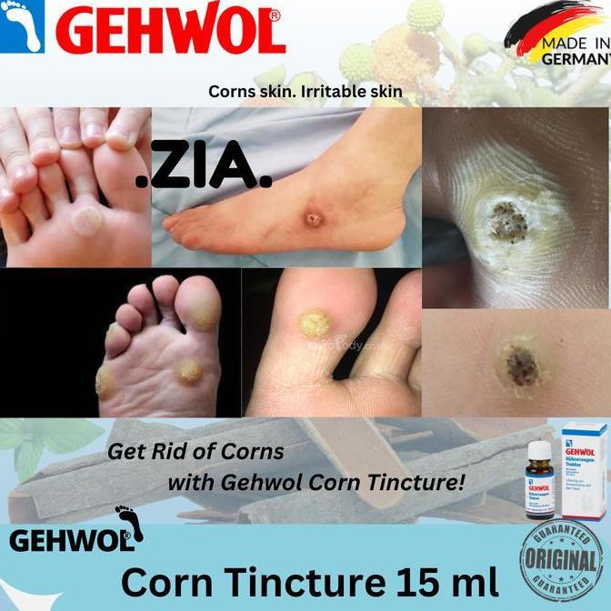 Cod,Bisa- Gehwol Corn Skin Tincture 15 Ml - Tinkur Kapalan Mata Ikan Us - Cairan Konsentrat Herbal R