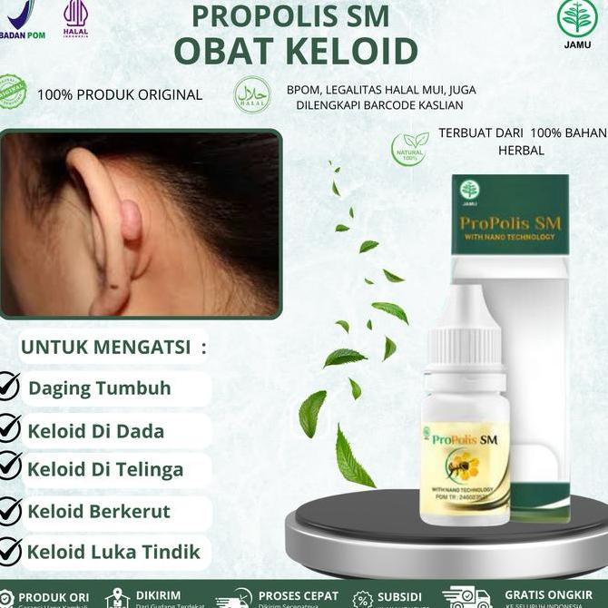Obat Keloid, Danging Tumbuh, Daging Jadi,Keloid Di Dada, Keloid Di Telinga, Keloid Luka tindik