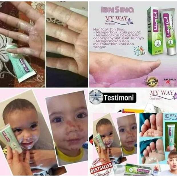 Selera Jualan - Ibnu Sina My Way Obat Krim Untuk Gatal ,Kaki Pecah Pecah, Obat Luka Import Mesir Egi