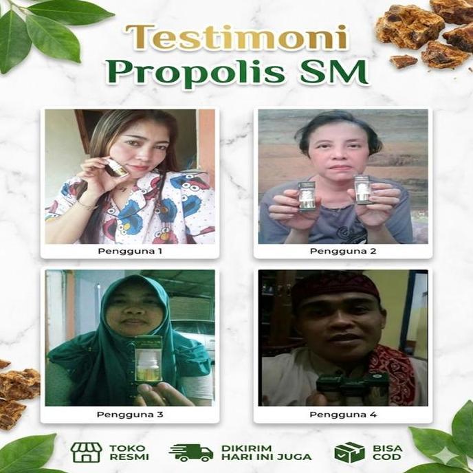 Excellent- Propolis Sm P Untuk Panu Hapur Kurap / Penghilang Panu Gatal Di Jah Tangan Kaki Hitam