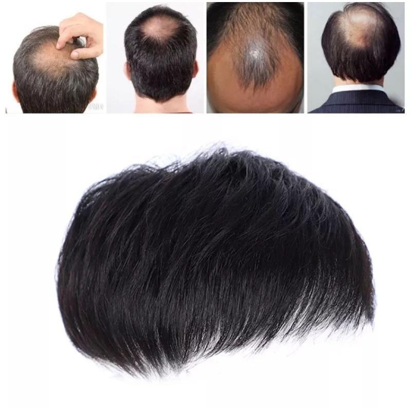 Rambut Palsu Penutup Botak / Toupee / Penutup Botak Pria
