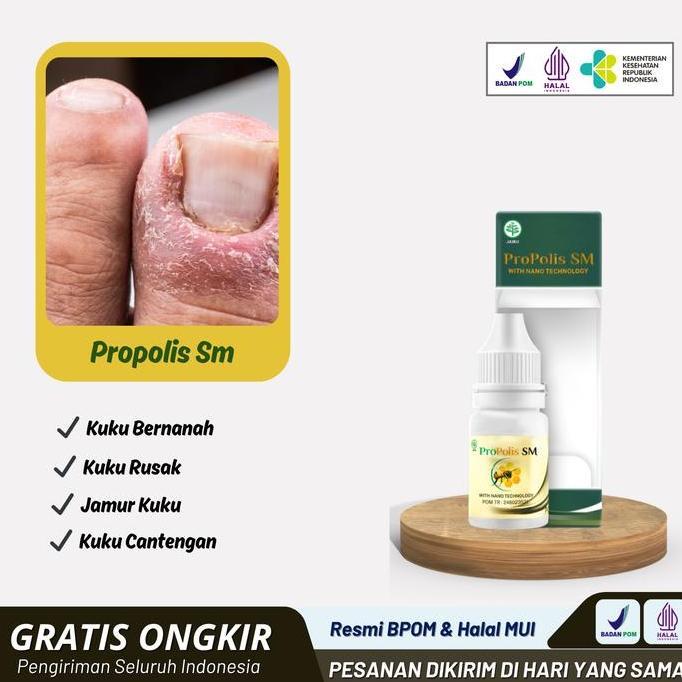 Propolis Sm - Cantengan Kuku Kaki Bengkak Bernanah BPOM