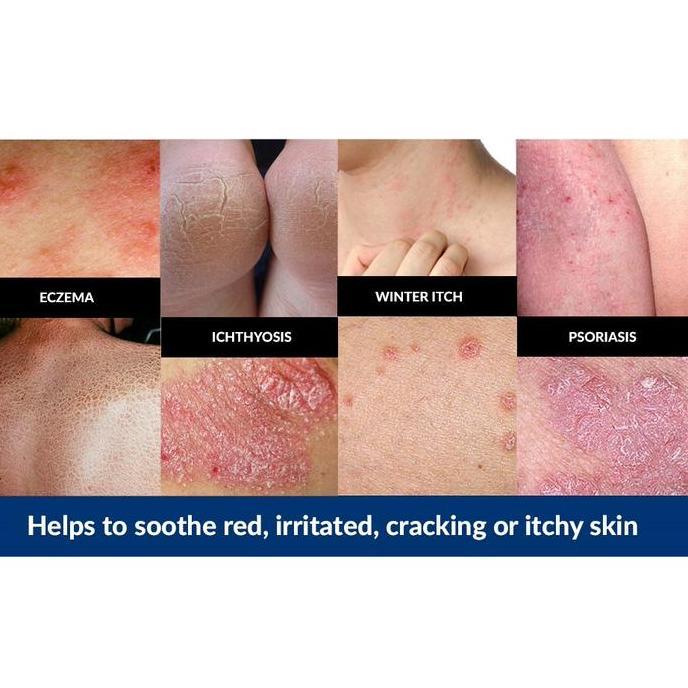Vanicream Moisturizing Skin Cream For Sensitive Eczema Psoriasis Itchy - Original