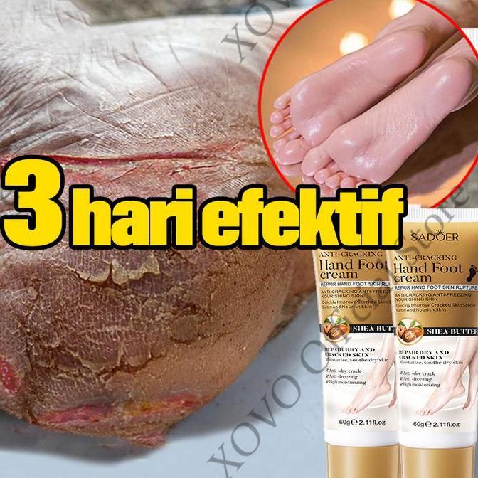 pelembab kaki pecah dan kering kaki obat kaki pecah dan kering krim 60g salep kaki pecah pecah kerin