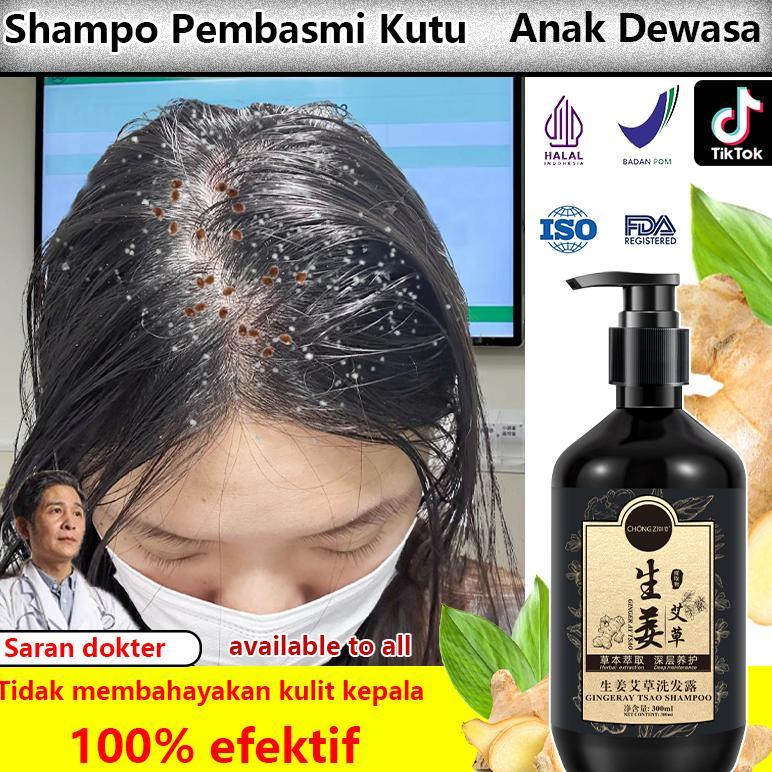 Ready Sampo Kutu Rambut Paling ampuh untuk Anak&Dewasa 300ml / Sampo Anti Ketombe / Pembersih Kulit 