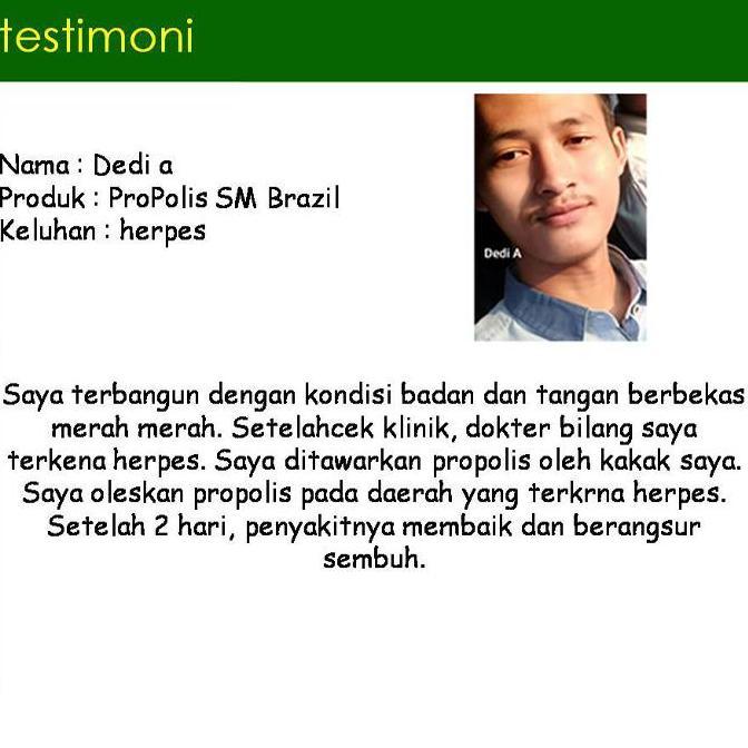 BEBAS ONGKIR - Propolis Sm Untuk Herpes Di Bibir Bibir Bengkak Bintik Bintik Di Mulut Luka Lepuh Di 