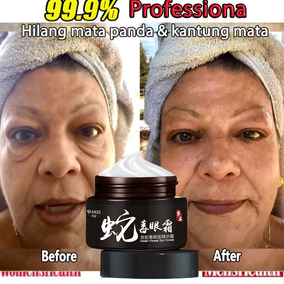 NEW QIANZI untuk Mengurangi Dark Circle Anti-Wrinkle Anti-agging Remover Eye terhadap Puffiness Dan 