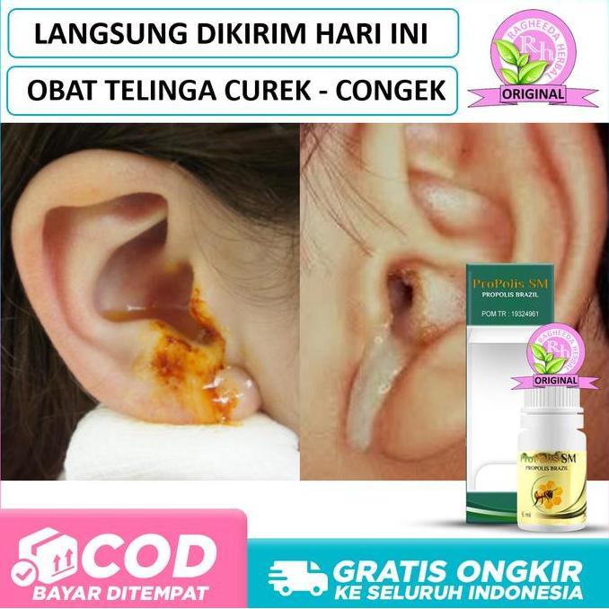 Obat Telinga Congek, Curek, Berdenging, Bernanah, Berair Kuning Bau
