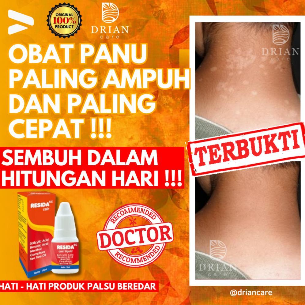 Terlaris Obat Panu Paling Ampuh 100% Obat Gatel Gatal Kadas Kurap Jamur Kutu Air Hapur Paling Ampuh 