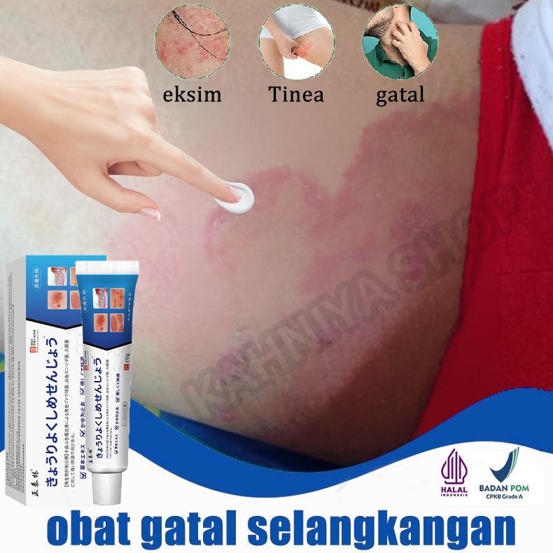 Terlaris Salep gatal paling ampuh salep jamur kulit gatal selangkangan dan hitam salep eksim salap g