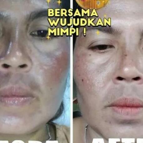 Paket Hemat Grya Beauty Serum Booster 10Ml Bodyserum 10Gr Dan Dna Salmon Soap 1Pcs Skincare Bpom Mur