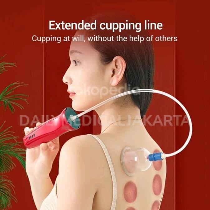 Alat Terapi Bekam Kop Angin Elektrik Cas - Electric Cupping Device