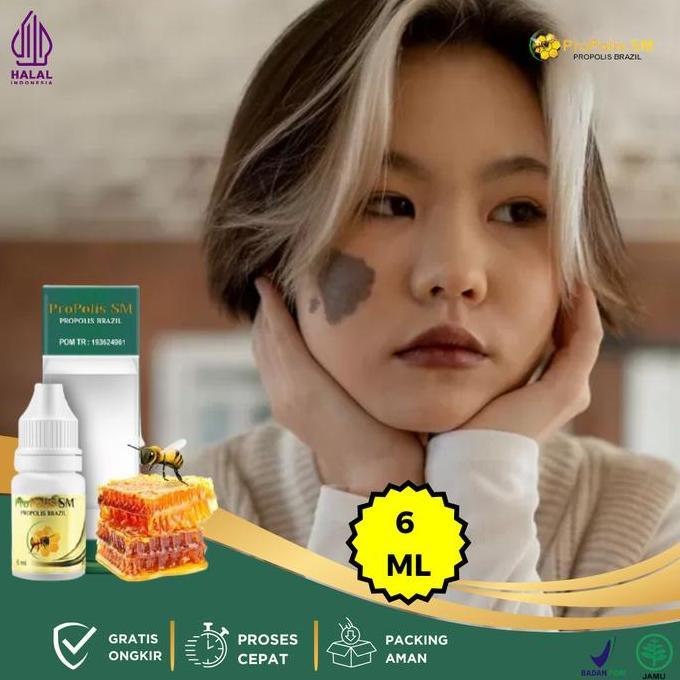 SUPER HEMAT - Penghilang Tanda Lahir, Tanda Lahir Hitam Coklat, Penghilang Tanda Lahir Di Wajah