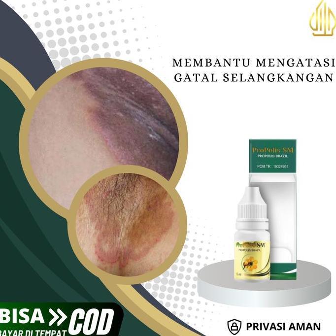 Propolis SM - Salep Gatal Selangkangan, Pemutih Selangkangan Hitam, Kurap Di Selangkangan, Selangkan