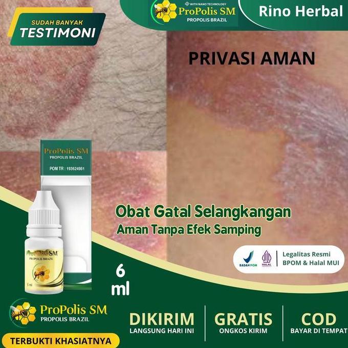 Gatal Selangkangan, Penghilang Gatal Selangkangan Hitam Pria/Wanita, Menghentikan Gatal Selangkangan