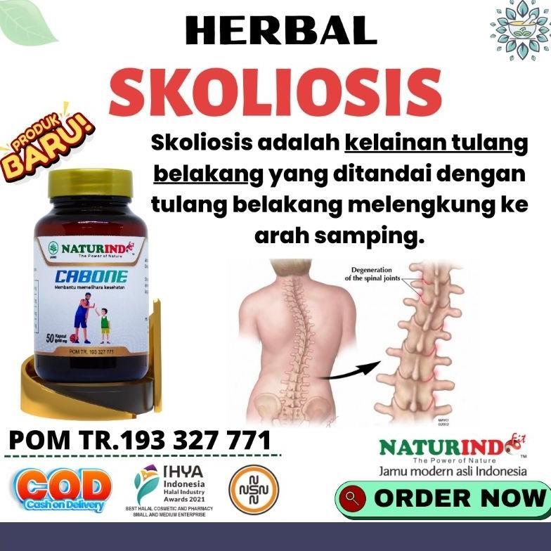 Obat Skoliosis Kelainan Tulang Belakang Kifosis Lordosis Tulang Bengkok Melengkung terlaris