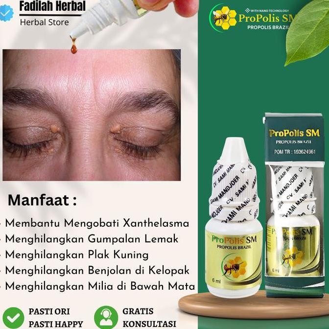 Obat Pembersih Xanthelasma Herbal Propolis SM Brazil
