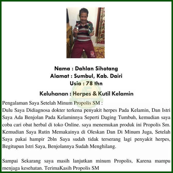Knochen- Obat Gatal Kemaluan Pria, Obat Gatal Kelamin Pria Lecet Herpes Kelamin