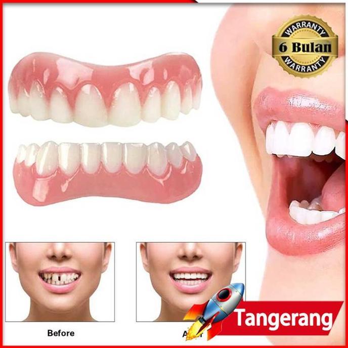 DEFAECO Gigi Palsu Instan Perfect Smile Veneer Gigi Tiruan Veneer Silikon