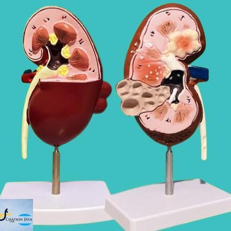 ALAT PERAGA MANEKIN MEDICAL ANATOMI GINJAL/Kerangka Ginjal Manusia