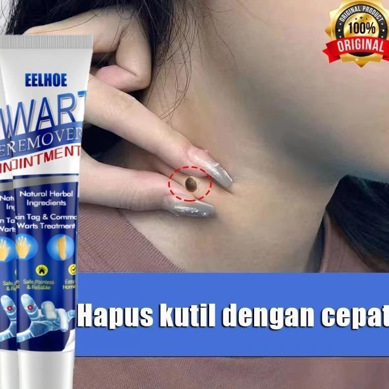 EELHOE Wart Remover Cream Skin Wart Removal Cream Mole Removal Cream Wart and Skin Tag Remover Remov