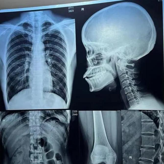 DIGITAL FILM INKJET MEDICAL DRY FILM A4