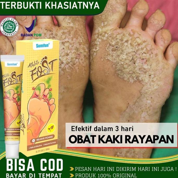salep gatel2 paling  Obat Telapak Kaki Rayapan 20g salep gatal kulit ampuh Obat Kaki Rayapan Bolong2