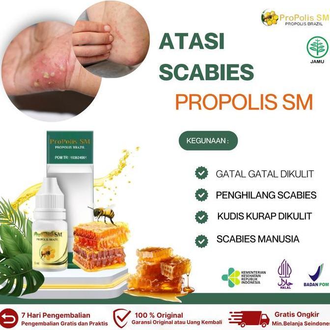 Propolis SM Penghilang Scabies Dan Kutu Hewan Dikulit, Scabies Pada Kulit Manusia, Penghilang Kudis,