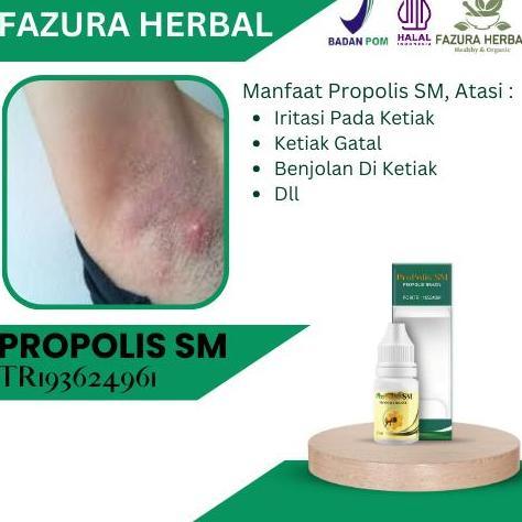 Propolis SM - Obat Iritasi Pada Ketiak, Obat Ketiak Gatal