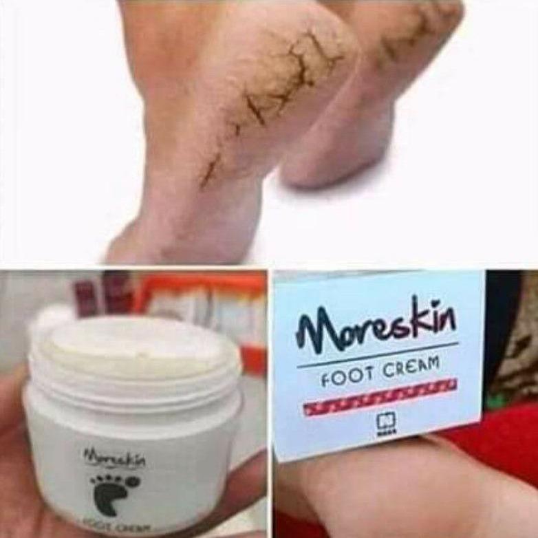 NEW Obat kaki pecah pecah dan kering dan kasar - Obat kaki rayapan dan bau - Obat kaki pecah dan ker