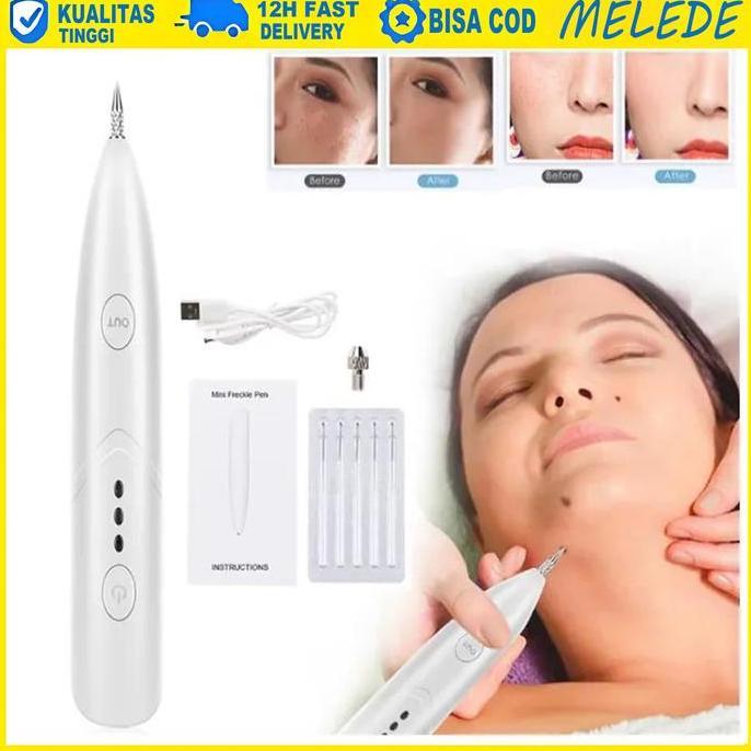 MELEDE Flek Kutil Tahi Lalat Tato Black Spot Removal Pen/ Alat Laser Plasma Pen Penghilang Kutil Tah
