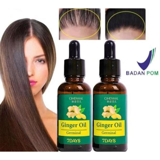 GAIZINPO Cindynal Ginger Hair Growth oil 7 days