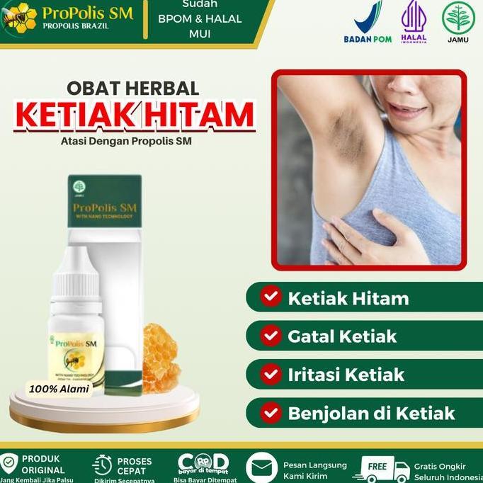 Propolis SM - Obat Oles Untuk Ketiak Hitam, Gatal Ketiak, Iritasi Ketiak, Gatal Merah Pada Ketiak De