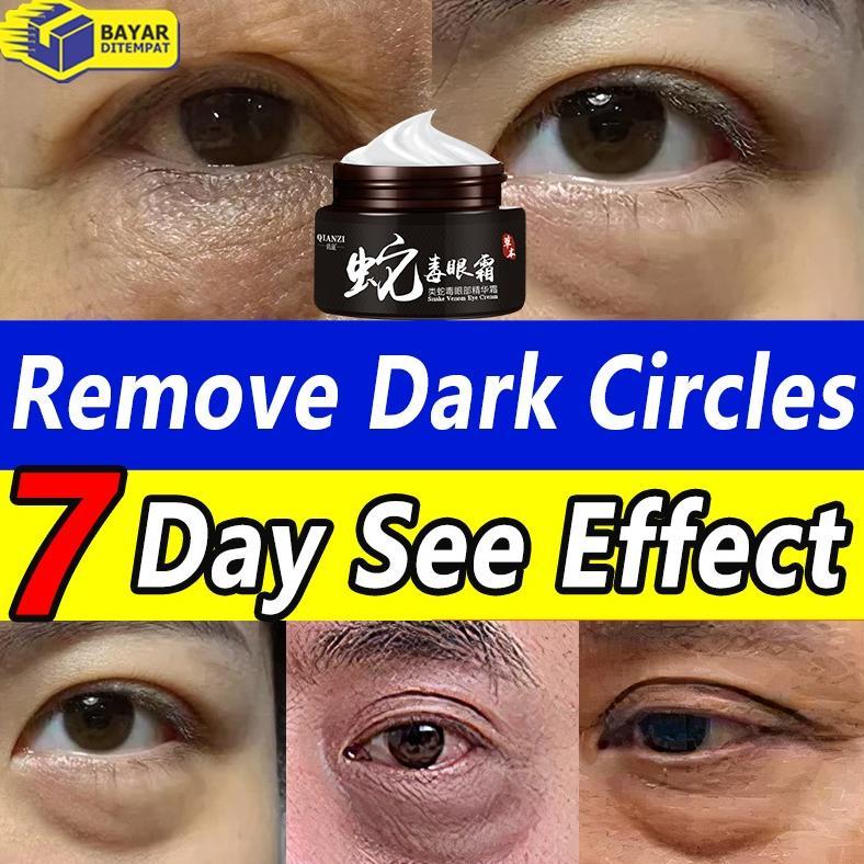 NEW Cream Mata Panda Aging Eye Cream Remove Dark Circles Repair Puffiness/krim menghilang kan kantun