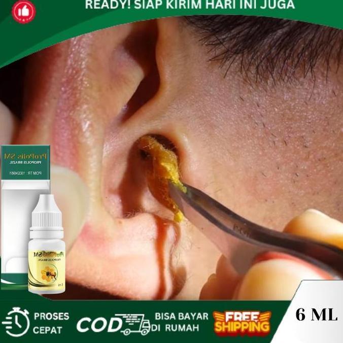 Pelunak Kotoran Telinga Yang Keras, Penghancur Kotoran Telinga Keras Kering, Tetes Kotoran Telinga, 
