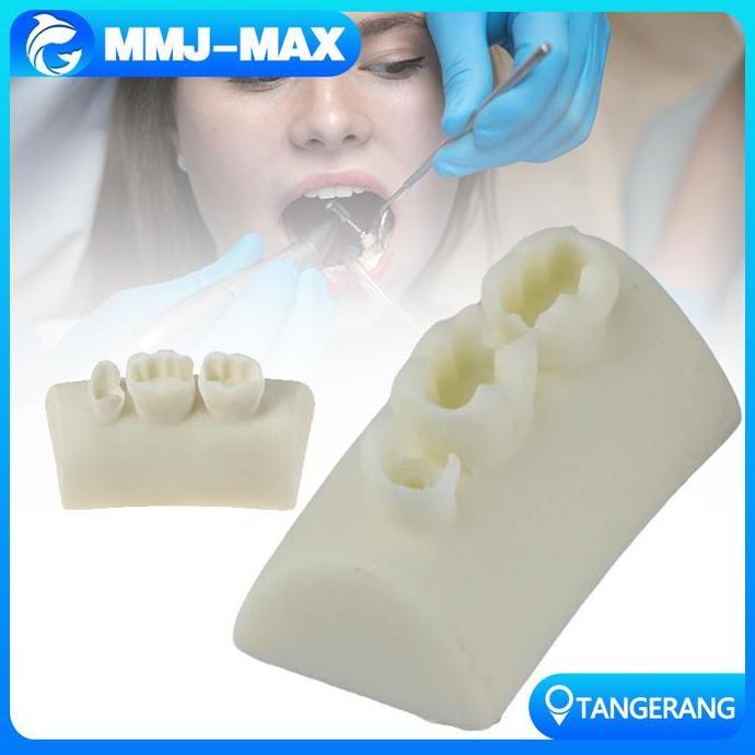 LEGOLANT Model Latihan Tambal Gigi/Model Tambalan Gigi/Dental Practice Model