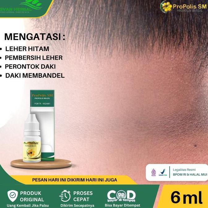 ProPolis SM Untuk Pemutih Leher Hitam, Memutihkan Tengkuk Leher Yang Hitam, Pemutih Daki Hitam Di Le