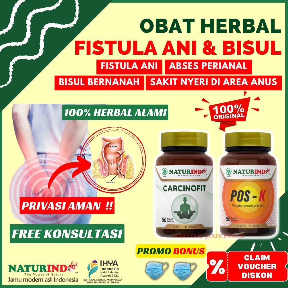 Obat Fistula Ani Bisul di Pantat Bisul Bernanah Herbal Abses Perianal Carcinofit Pos K Obat Bisul Ob